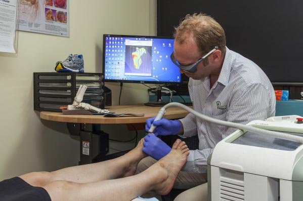 Chris Hope of Entire Podiatry treating a patient with fungal nail using the Cutera Gensis laser