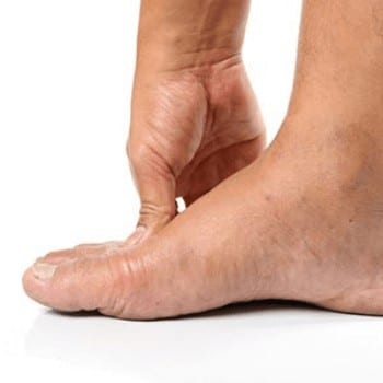 Toe Arthritis - Entire Podiatry Brisbane