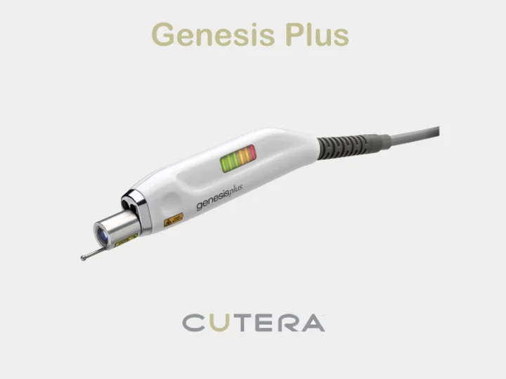 Cutera GenesisPlus laser - best treatment for removing plantar warts