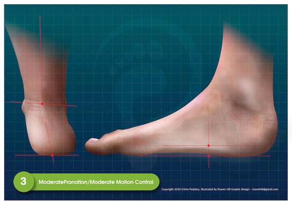 Moderately Pronated Feet - View Podiatrist Recommended Moderate Motion Control Shoes