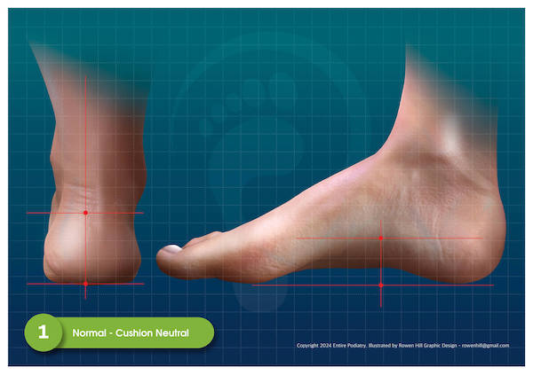 Normal Feet - View Podiatrist Recommended Cushion Neutral Shoes