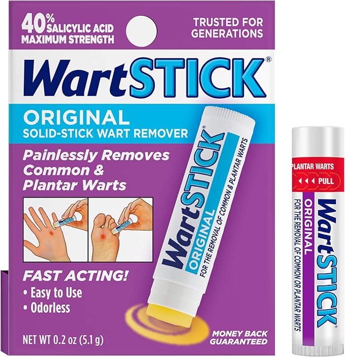 WartStick Wart Remover